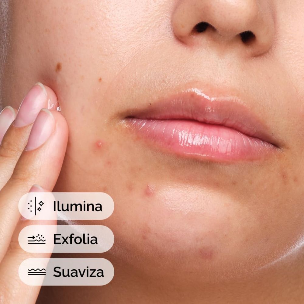 SALICYLIC ACID 2% SOLUTION (SUERO ANTI-IMPERFECCIONES CON &Aacute;CIDO SALIC&Iacute;LICO)